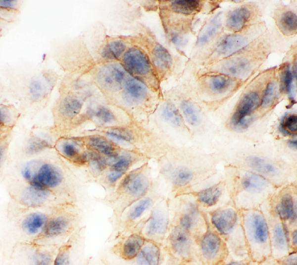 gamma Catenin Antibody in Immunocytochemistry (ICC/IF)