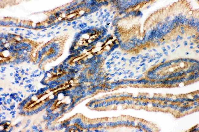 gamma Catenin Antibody in Immunohistochemistry (Paraffin) (IHC (P))