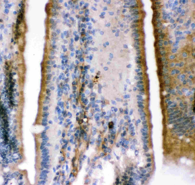 KCNMA1 Antibody in Immunohistochemistry (Paraffin) (IHC (P))