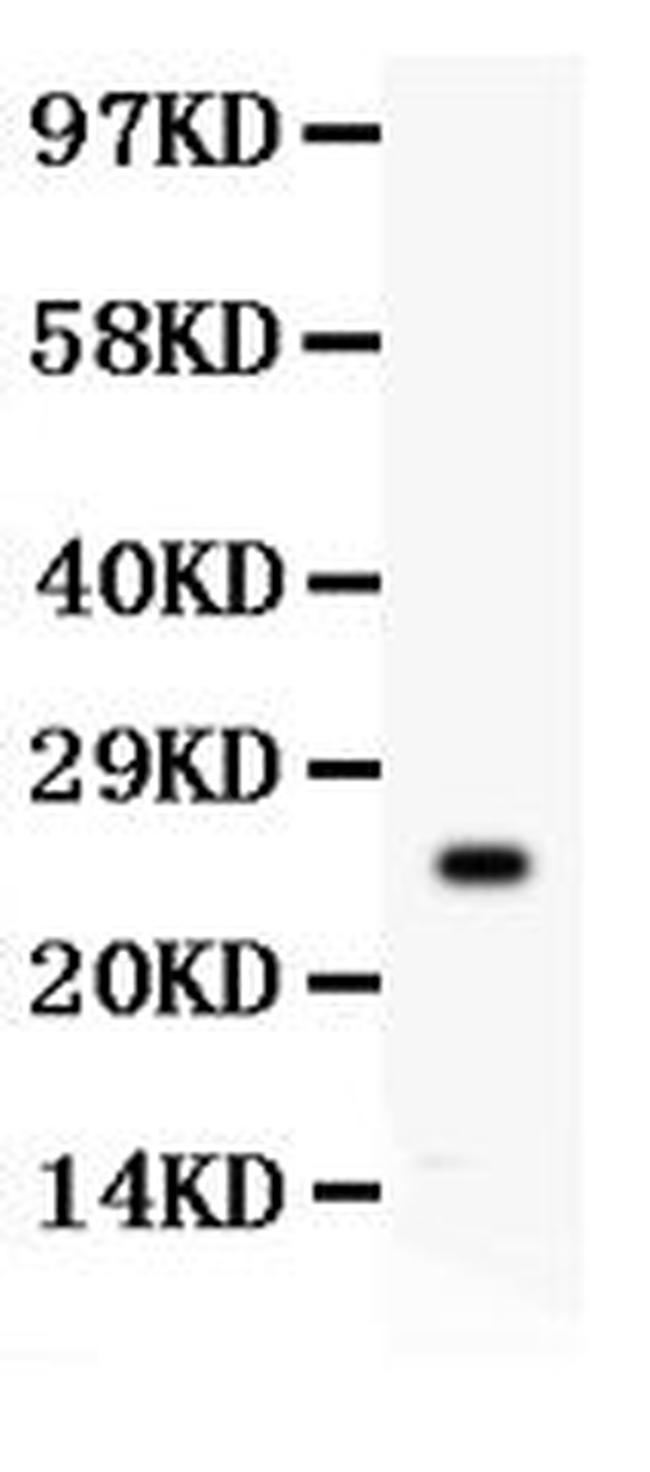 Kallikrein 4 Antibody in Western Blot (WB)