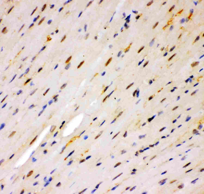 MSK1 Antibody in Immunohistochemistry (Paraffin) (IHC (P))