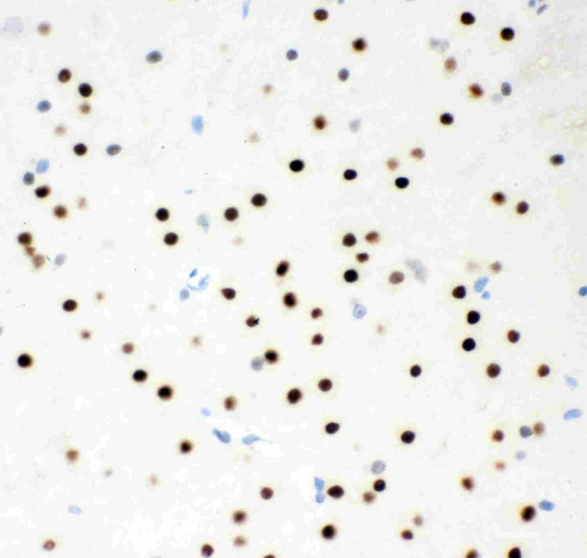 MSK1 Antibody in Immunohistochemistry (Paraffin) (IHC (P))