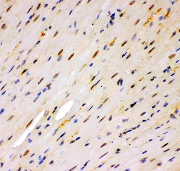 MSK1 Antibody in Immunohistochemistry (Paraffin) (IHC (P))