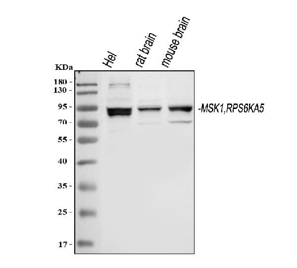 MSK1 Antibody in Western Blot (WB)