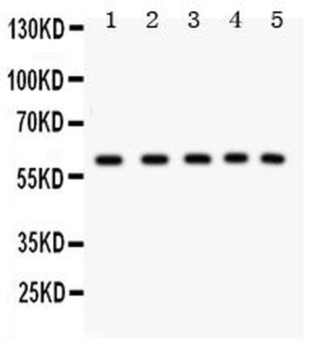 LKB1 Antibody in Western Blot (WB)