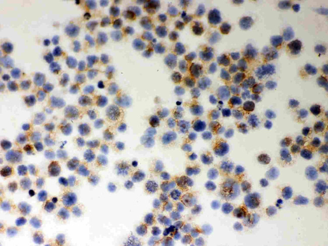 MIF Antibody in Immunocytochemistry (ICC/IF)