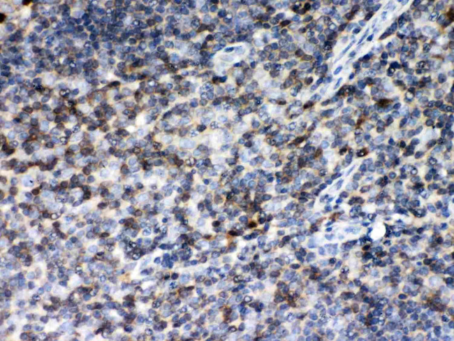 MIF Antibody in Immunohistochemistry (Paraffin) (IHC (P))