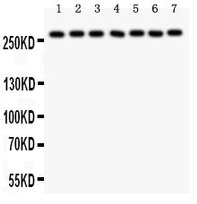 LRRK2 Antibody in Western Blot (WB)