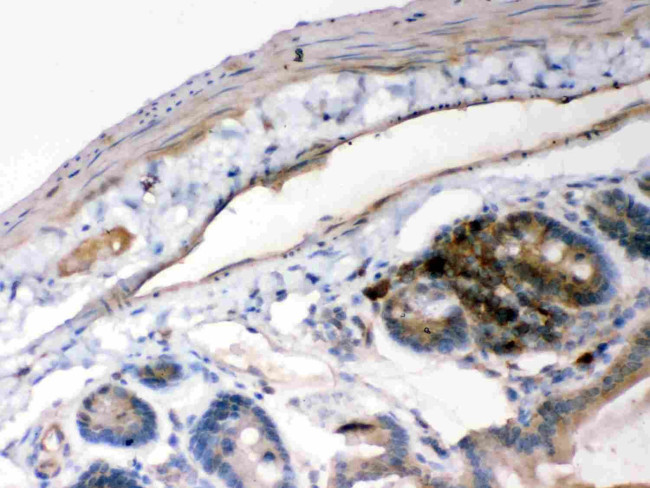 IkB alpha Antibody in Immunohistochemistry (Paraffin) (IHC (P))