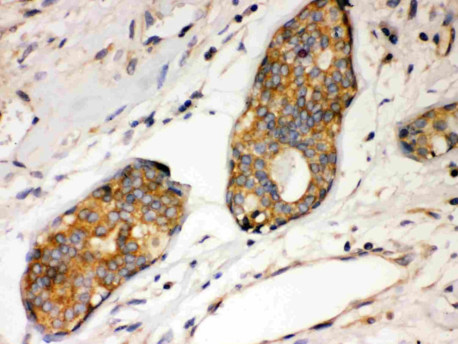 IkB alpha Antibody in Immunohistochemistry (Paraffin) (IHC (P))