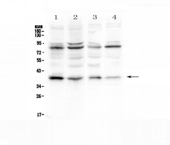 IkB alpha Antibody in Western Blot (WB)