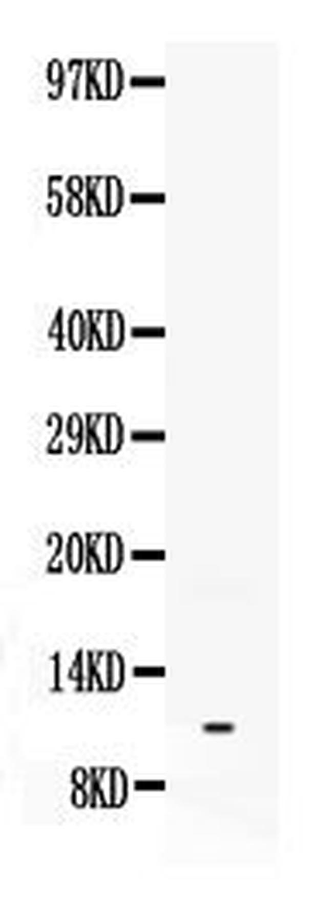 NPY Antibody in Western Blot (WB)