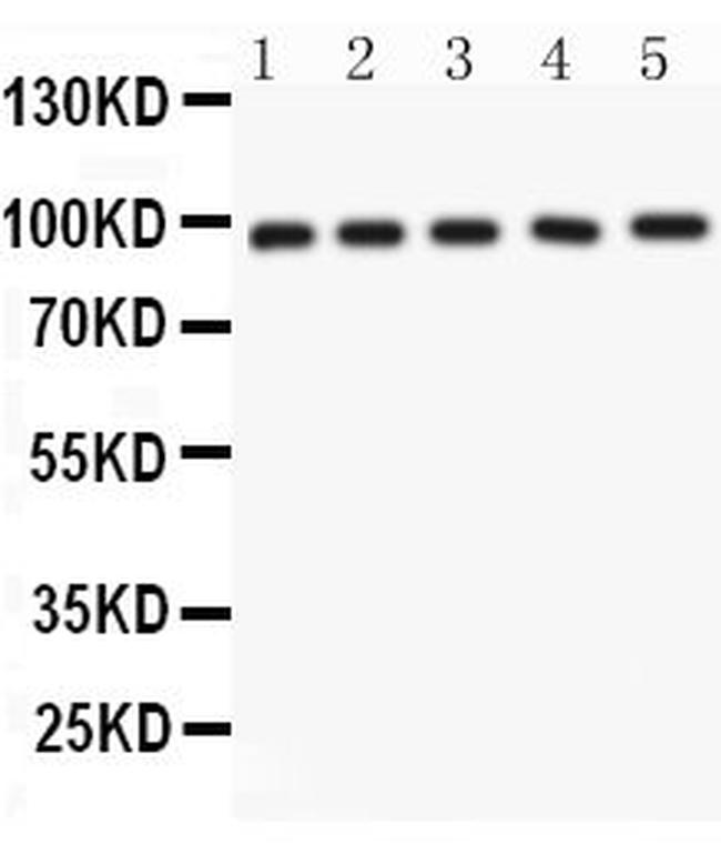 NUP98 Antibody in Western Blot (WB)