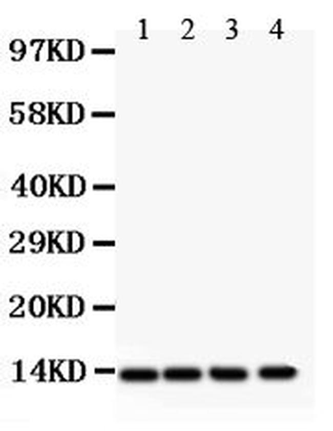 PDGF-B Antibody in Western Blot (WB)