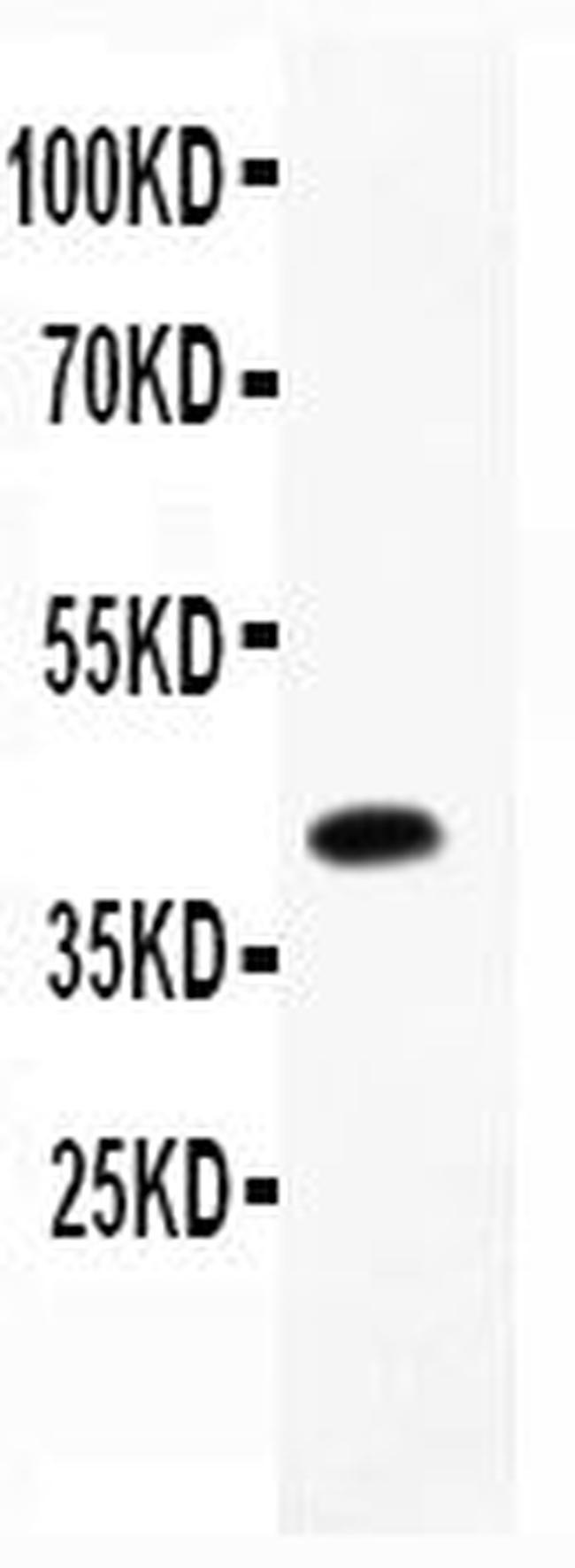 NAE1 Antibody in Western Blot (WB)