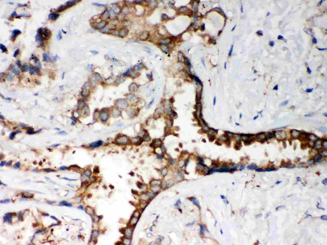 PP2A alpha Antibody in Immunohistochemistry (Paraffin) (IHC (P))