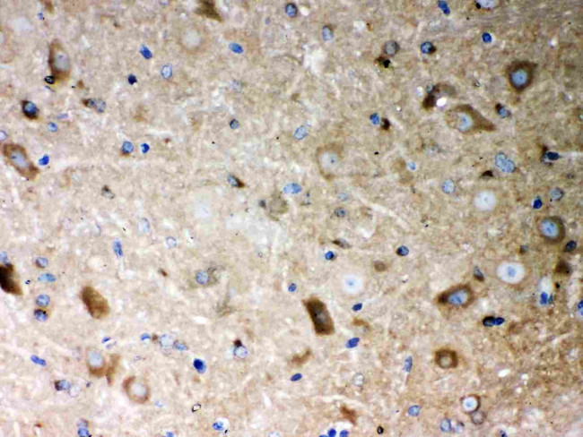 PP2A alpha Antibody in Immunohistochemistry (Paraffin) (IHC (P))