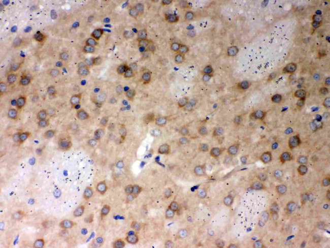 PP2A alpha Antibody in Immunohistochemistry (Paraffin) (IHC (P))