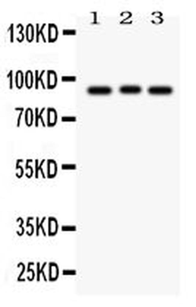 SEMA3A Antibody in Western Blot (WB)