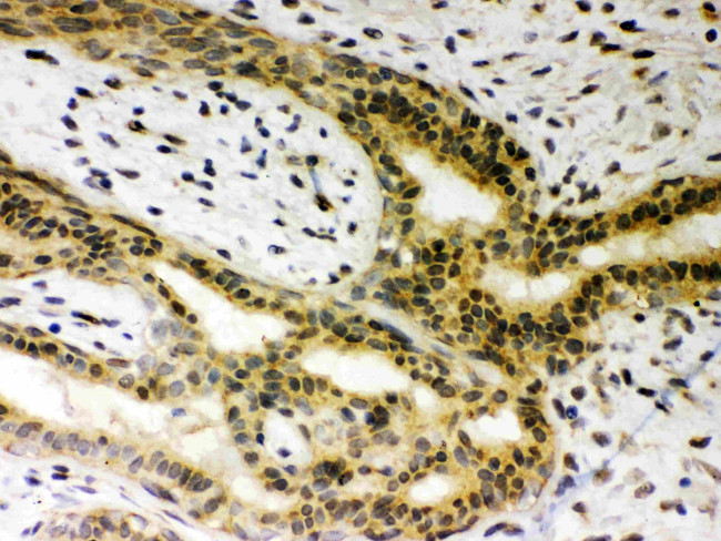 SIRT6 Antibody in Immunohistochemistry (Paraffin) (IHC (P))