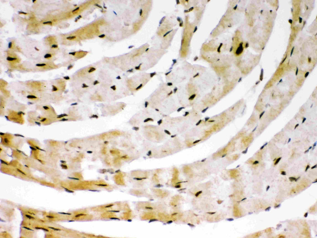 SIRT6 Antibody in Immunohistochemistry (Paraffin) (IHC (P))