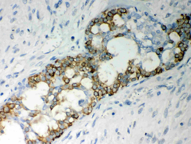 Caspase 7 Antibody in Immunohistochemistry (Paraffin) (IHC (P))