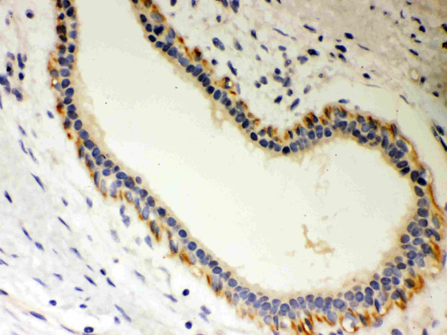 STRAP Antibody in Immunohistochemistry (Paraffin) (IHC (P))