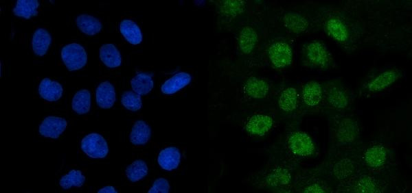 Cyclin A2 Antibody in Immunocytochemistry (ICC/IF)