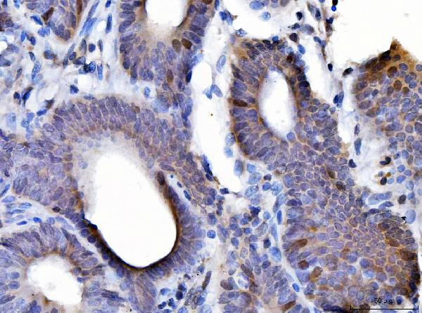 Cyclin A2 Antibody in Immunohistochemistry (Paraffin) (IHC (P))