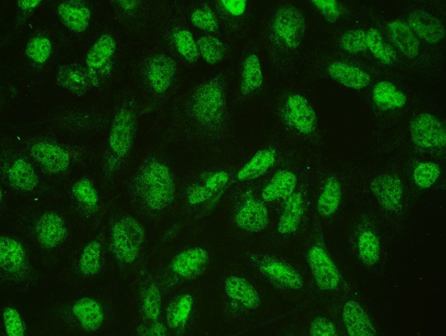 CtBP1 Antibody in Immunocytochemistry (ICC/IF)