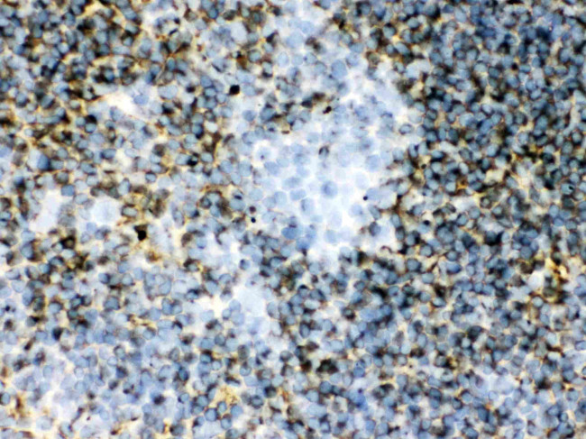 TGM2 Antibody in Immunohistochemistry (Frozen) (IHC (F))