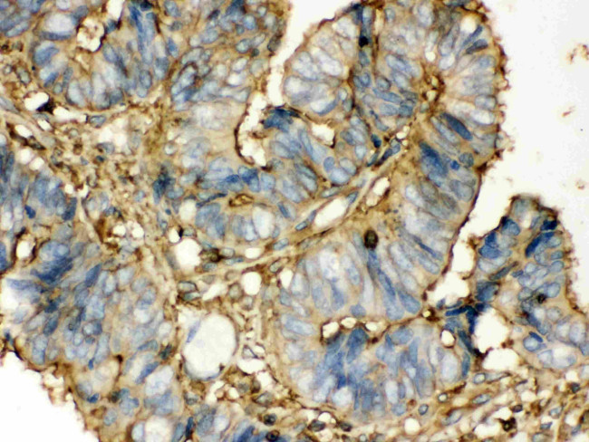 TGM2 Antibody in Immunohistochemistry (Paraffin) (IHC (P))