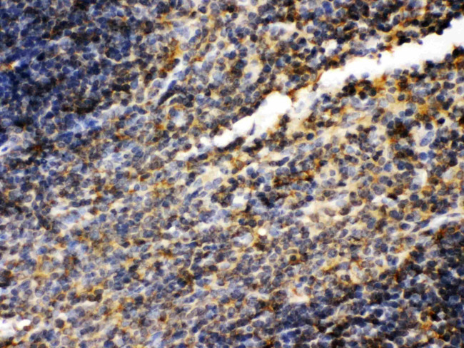 TGM2 Antibody in Immunohistochemistry (Paraffin) (IHC (P))