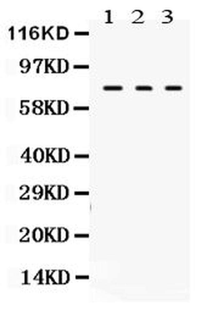 TGM2 Antibody in Western Blot (WB)