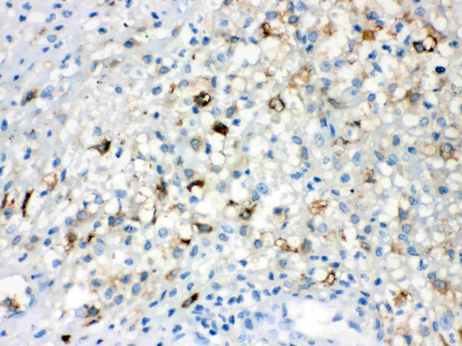 TLR5 Antibody in Immunohistochemistry (Paraffin) (IHC (P))