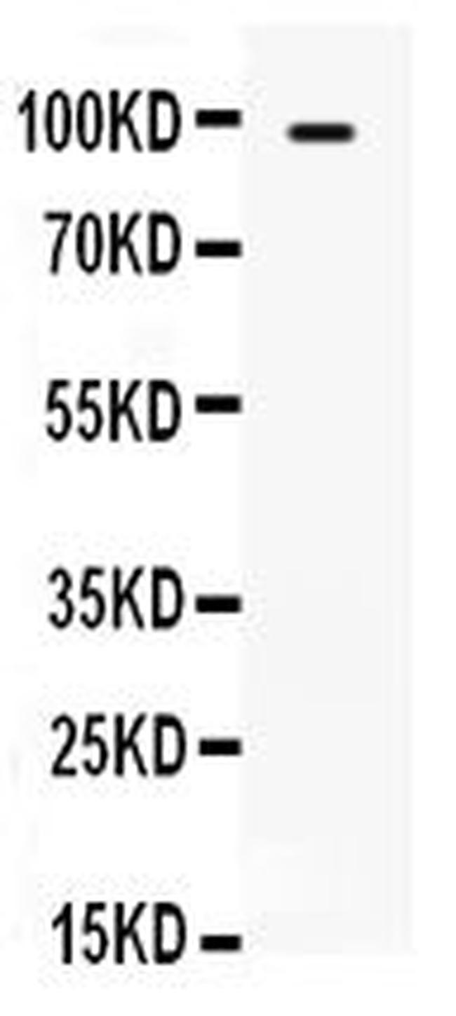 TLR5 Antibody in Western Blot (WB)