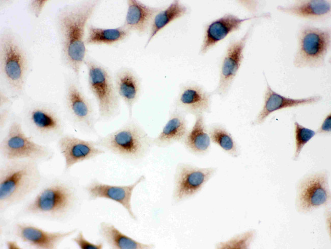 TLR7 Antibody in Immunocytochemistry (ICC/IF)