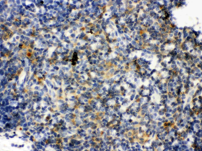 TLR7 Antibody in Immunohistochemistry (Paraffin) (IHC (P))