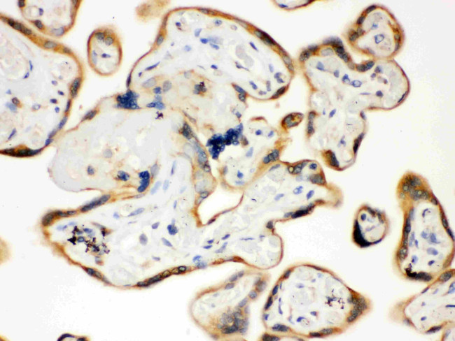 TLR7 Antibody in Immunohistochemistry (Paraffin) (IHC (P))