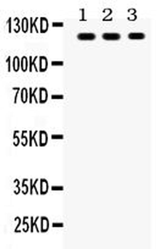 TLR7 Antibody in Western Blot (WB)