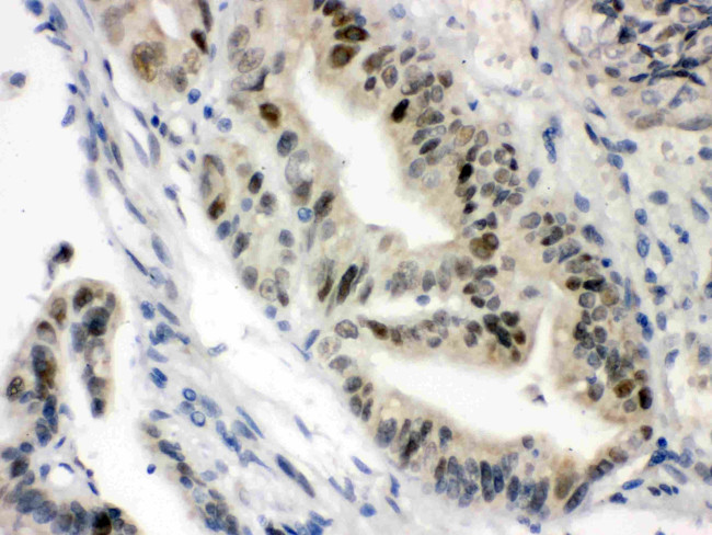 VDR Antibody in Immunohistochemistry (Paraffin) (IHC (P))