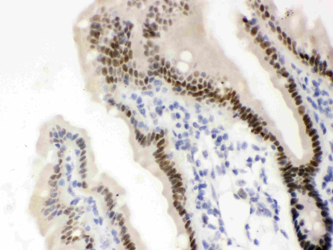 VDR Antibody in Immunohistochemistry (Paraffin) (IHC (P))