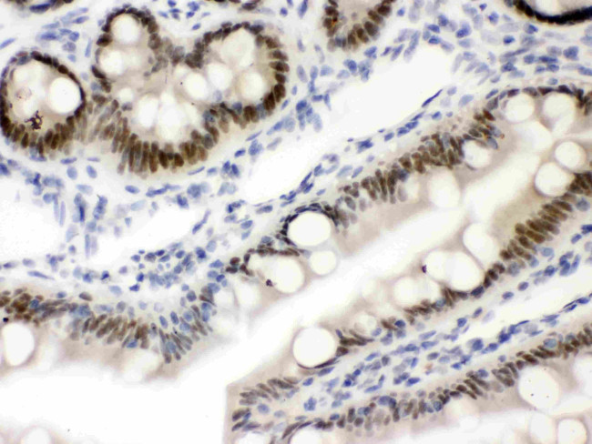 VDR Antibody in Immunohistochemistry (Paraffin) (IHC (P))