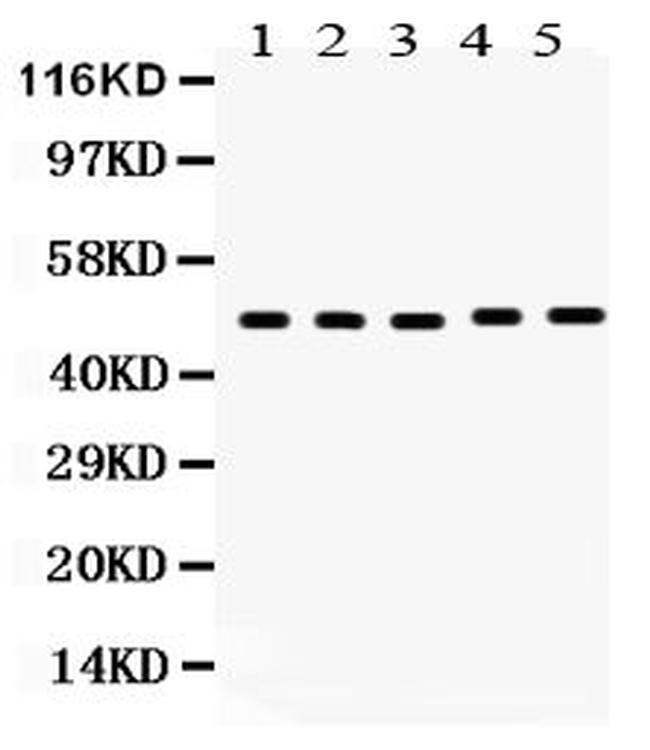 VDR Antibody in Western Blot (WB)