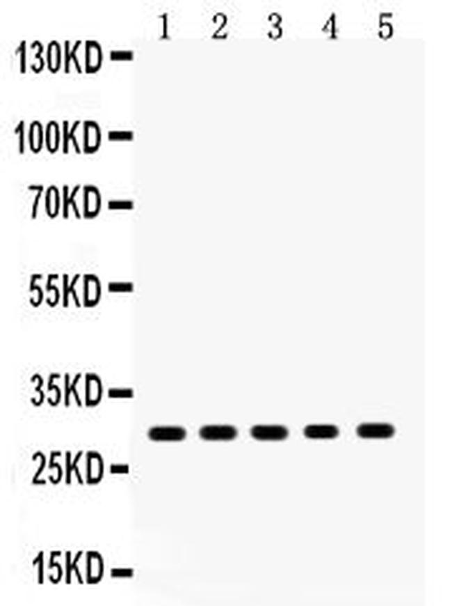 XBP1 Antibody in Western Blot (WB)