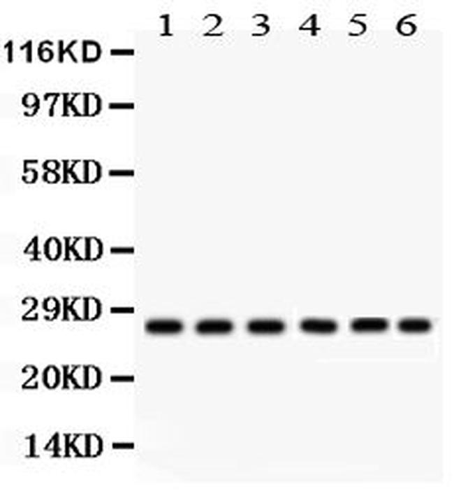 Calmyrin Antibody in Western Blot (WB)