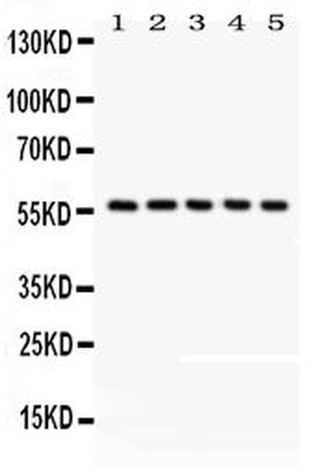 CREB3L1 Antibody in Western Blot (WB)