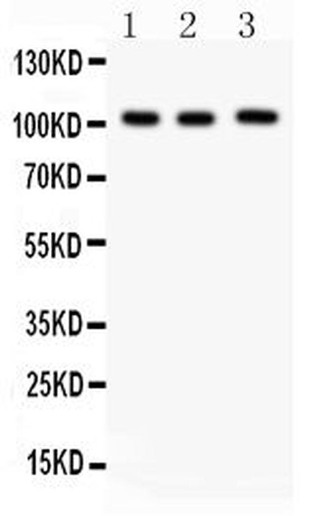 ITCH Antibody in Western Blot (WB)