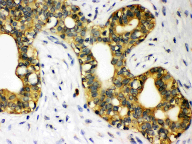 STAT1 Antibody in Immunohistochemistry (Paraffin) (IHC (P))