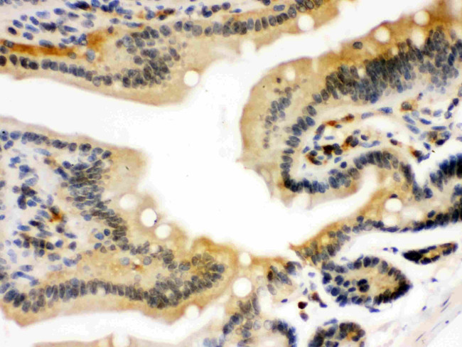 STAT1 Antibody in Immunohistochemistry (Paraffin) (IHC (P))